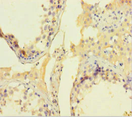 Immunohistochemistry (Formalin/PFA-fixed paraffin-embedded sections) - Anti-CNKR2 antibody (AB239026)