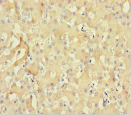 Immunohistochemistry (Formalin/PFA-fixed paraffin-embedded sections) - Anti-CNKR2 antibody (AB239026)