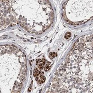 Immunohistochemistry (Formalin/PFA-fixed paraffin-embedded sections) - Anti-CNNM1 antibody (AB122648)