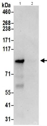 Immunoprecipitation - Anti-CNNM4 antibody (AB191207)