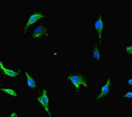 Immunocytochemistry/ Immunofluorescence - Anti-CNOT1 antibody (AB234642)