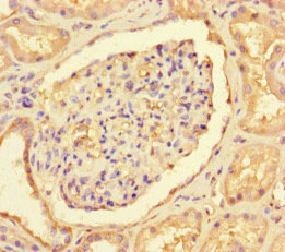 Immunohistochemistry (Formalin/PFA-fixed paraffin-embedded sections) - Anti-CNOT1 antibody (AB234642), expandable thumbnail