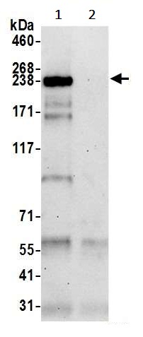 Immunoprecipitation - Anti-CNOT1 antibody (AB241479)