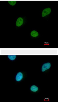 Immunocytochemistry/ Immunofluorescence - Anti-CNOT3 antibody (AB154276), expandable thumbnail