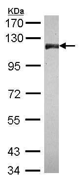 Western blot - Anti-CNOT3 antibody (AB154276)