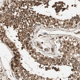 Immunohistochemistry (Formalin/PFA-fixed paraffin-embedded sections) - Anti-CNOT4 antibody (AB214937)