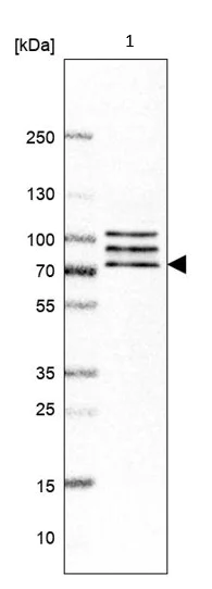 Western blot - Anti-CNOT4 antibody (AB214937)