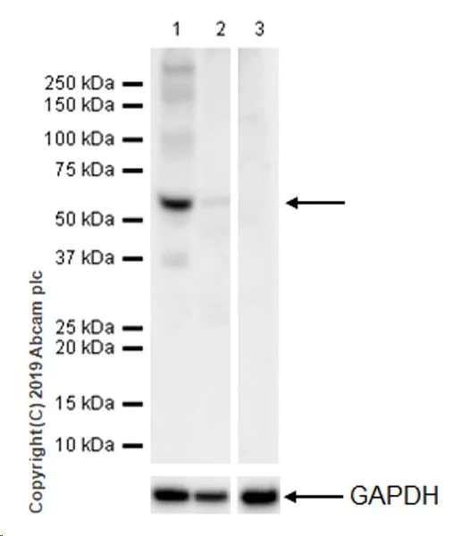 Western blot - Anti-CNOT6 antibody [EPR22022] (AB221151)