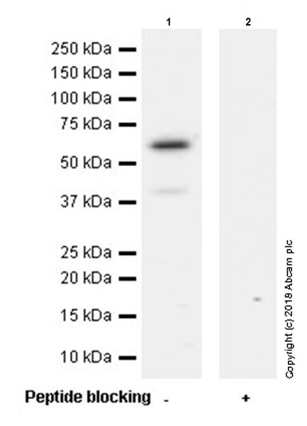 Western blot - Anti-CNOT6 antibody [EPR22022] (AB221151), expandable thumbnail