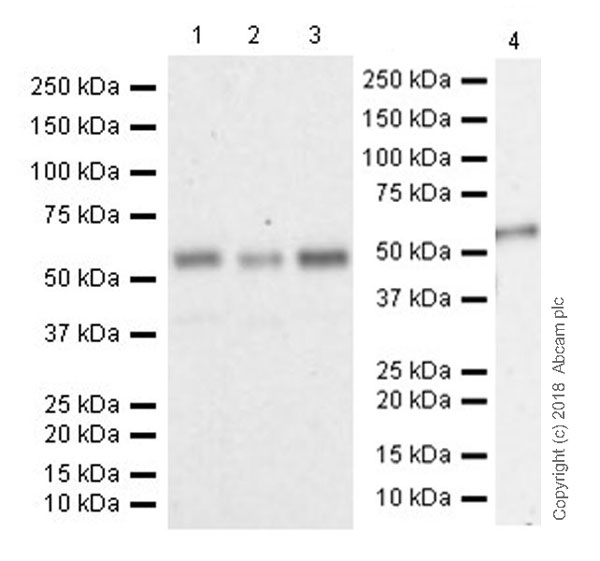 Western blot - Anti-CNOT6 antibody [EPR22022] (AB221151), expandable thumbnail