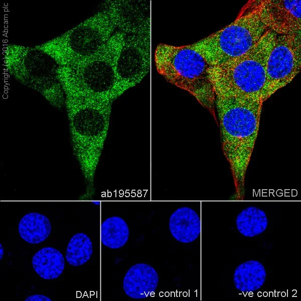 Immunocytochemistry/ Immunofluorescence - Anti-CNOT7 antibody [EPR18722] (AB195587)