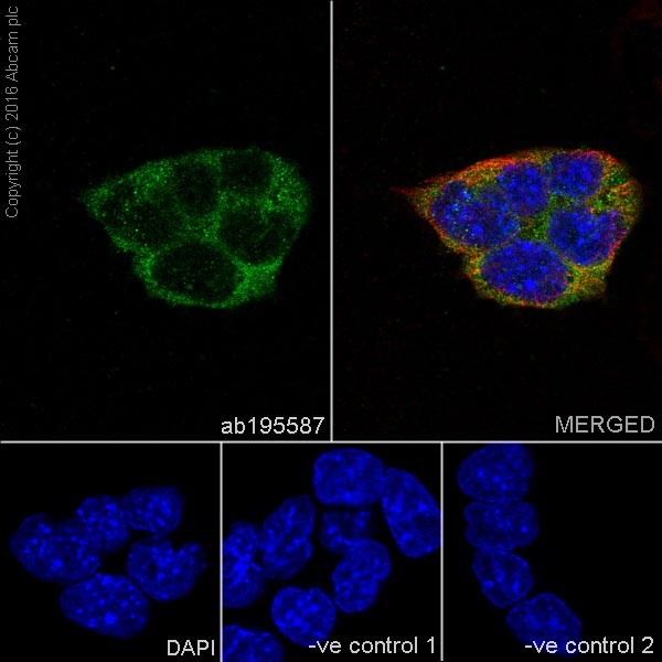 Immunocytochemistry/ Immunofluorescence - Anti-CNOT7 antibody [EPR18722] (ab195587), expandable thumbnail