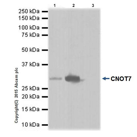 Immunoprecipitation - Anti-CNOT7 antibody [EPR18722] (AB195587), expandable thumbnail