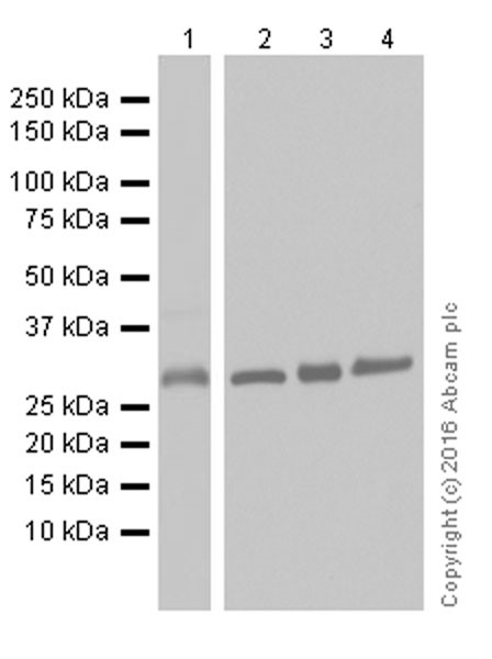 Western blot - Anti-CNOT7 antibody [EPR18722] (ab195587), expandable thumbnail
