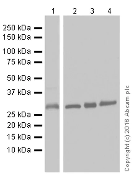 Western blot - Anti-CNOT7 antibody [EPR18722] (AB195587)