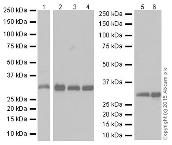 Western blot - Anti-CNOT7 antibody [EPR18722] (AB195587), expandable thumbnail