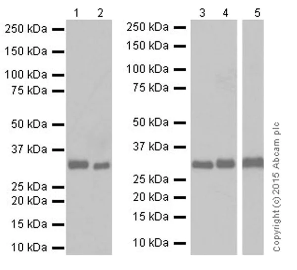 Western blot - Anti-CNOT7 antibody [EPR18722] (AB195587)