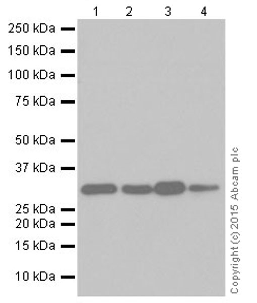 Western blot - Anti-CNOT7 antibody [EPR18722] (AB195587), expandable thumbnail