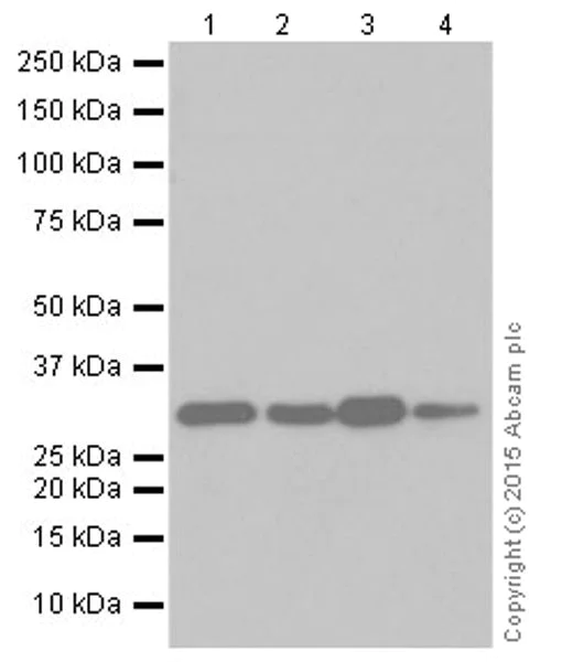 Western blot - Anti-CNOT7 antibody [EPR18722] (AB195587)