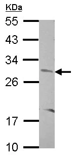 Western blot - Anti-CNOT8 antibody (AB155911)