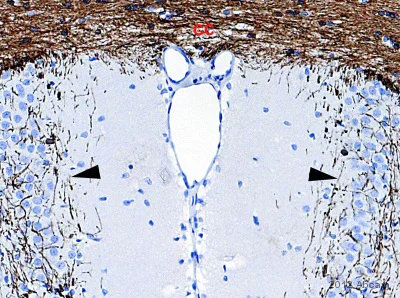 Immunohistochemistry (Formalin/PFA-fixed paraffin-embedded sections) - Anti-CNPase antibody [11-5B] (AB6319)