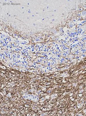 Immunohistochemistry (Formalin/PFA-fixed paraffin-embedded sections) - Anti-CNPase antibody [11-5B] (AB6319)
