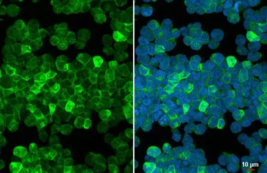 Immunocytochemistry/ Immunofluorescence - Anti-CNPase antibody (AB227218)