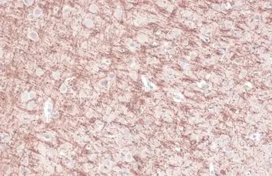 Immunohistochemistry (Formalin/PFA-fixed paraffin-embedded sections) - Anti-CNPase antibody (AB227218)