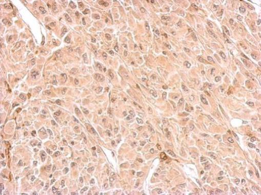 Immunohistochemistry (Formalin/PFA-fixed paraffin-embedded sections) - Anti-CNPase antibody (AB227218), expandable thumbnail