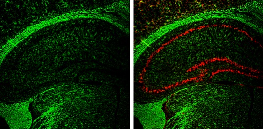 Immunohistochemistry (Frozen sections) - Anti-CNPase antibody (ab227218), expandable thumbnail