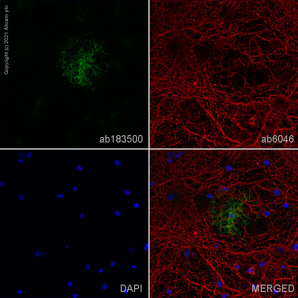 Immunocytochemistry/ Immunofluorescence - Anti-CNPase antibody [EPR13005] (AB183500)
