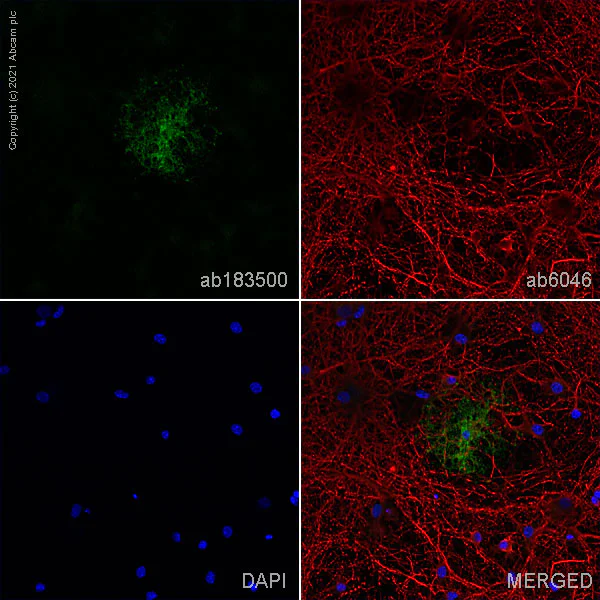 Immunocytochemistry/ Immunofluorescence - Anti-CNPase antibody [EPR13005] (AB183500)