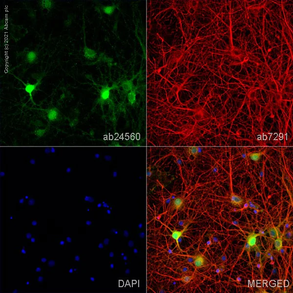 Immunocytochemistry/ Immunofluorescence - Anti-CNPase antibody [EPR13005] - BSA and Azide free (AB250658)