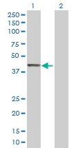 Western blot - CNPase overexpression 293T lysate (whole cell) (AB94074)