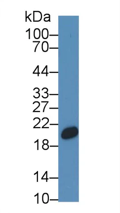 Western blot - Anti-CNPY2/MSAP antibody (AB233136)