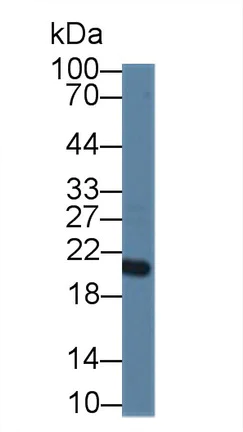 Western blot - Anti-CNPY2/MSAP antibody (AB233136)