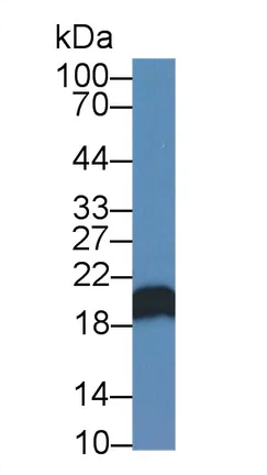 Western blot - Anti-CNPY2/MSAP antibody (AB233136)