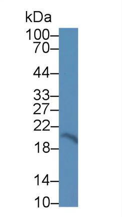 Western blot - Anti-CNPY2/MSAP antibody (AB233136)