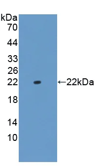 Western blot - Anti-CNPY2/MSAP antibody (AB233136)