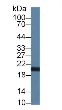 Western blot - Anti-CNPY2/MSAP antibody (AB233136)