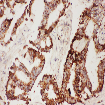 Immunohistochemistry (Formalin/PFA-fixed paraffin-embedded sections) - Anti-CNTF antibody (AB190985), expandable thumbnail