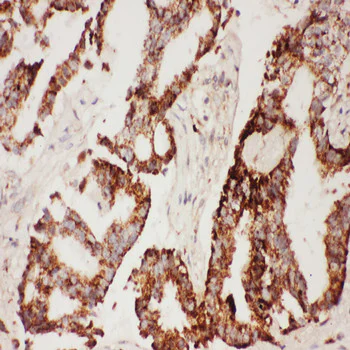 Immunohistochemistry (Formalin/PFA-fixed paraffin-embedded sections) - Anti-CNTF antibody (AB190985)