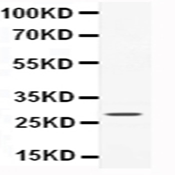 Western blot - Anti-CNTF antibody (AB190985), expandable thumbnail
