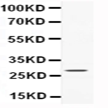 Western blot - Anti-CNTF antibody (AB190985)