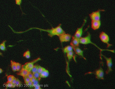 Immunocytochemistry/ Immunofluorescence - Anti-CNTF antibody (AB46172)