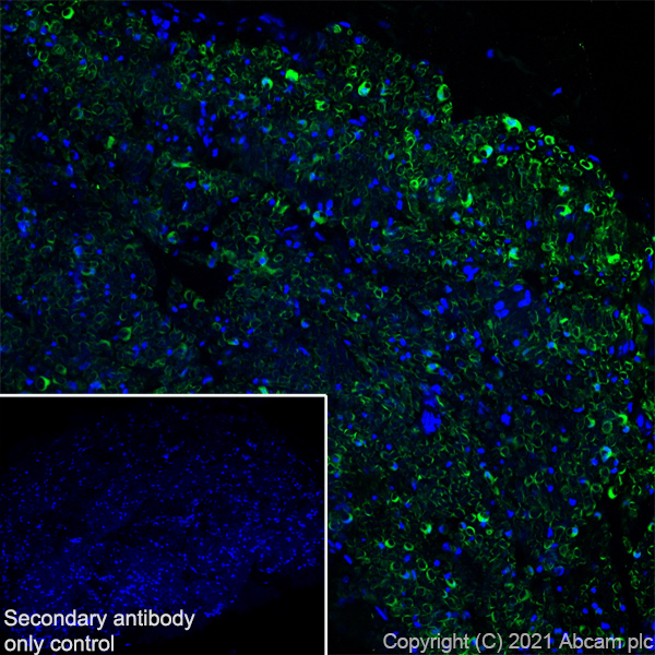 Immunohistochemistry (Frozen sections) - Anti-CNTF antibody [EPR24553-104] (ab270992), expandable thumbnail