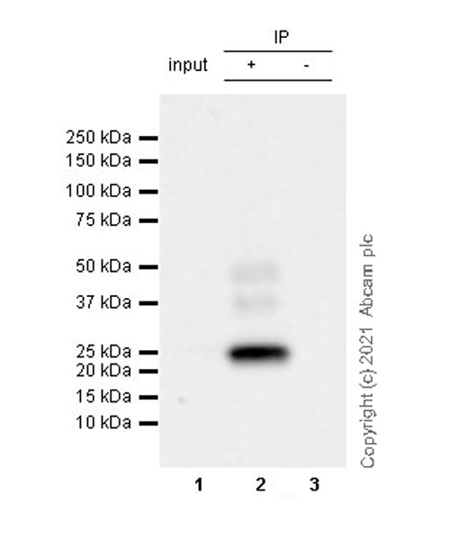 Immunoprecipitation - Anti-CNTF antibody [EPR24553-104] (ab270992), expandable thumbnail