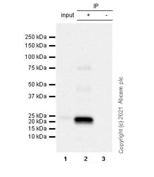 Immunoprecipitation - Anti-CNTF antibody [EPR24553-104] (ab270992), expandable thumbnail