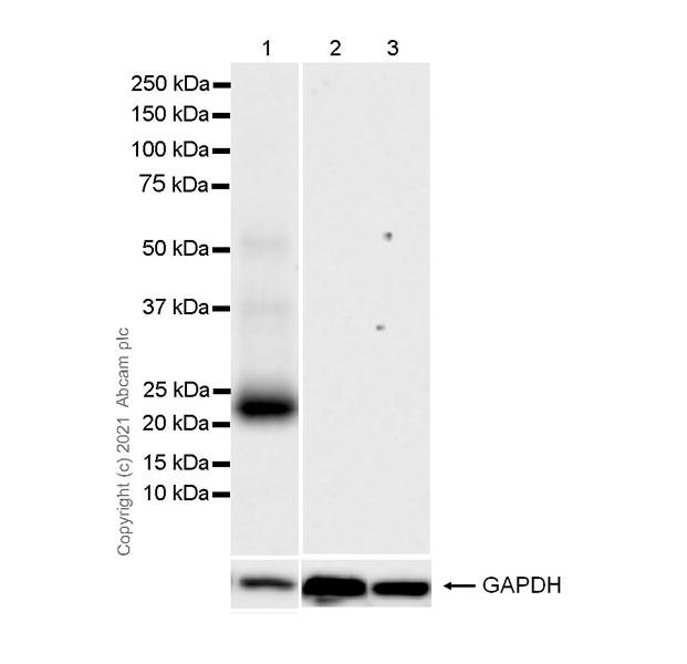 Western blot - Anti-CNTF antibody [EPR24553-104] (AB270992), expandable thumbnail