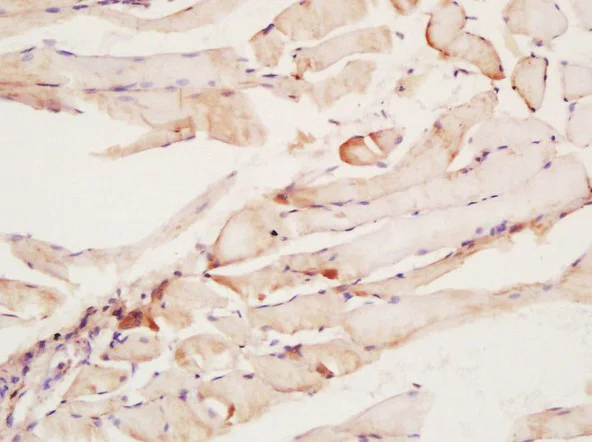 Immunohistochemistry (Formalin/PFA-fixed paraffin-embedded sections) - Anti-CNTFR antibody (AB203024)
